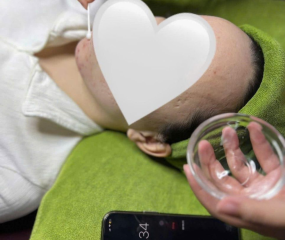 Chăm sóc da mặt quận 2 cho da mụn – Giải pháp an toàn, không để sẹo