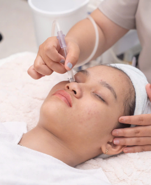 Xử lý nám, tàn nhang, đồi mồi – Mức độ 3