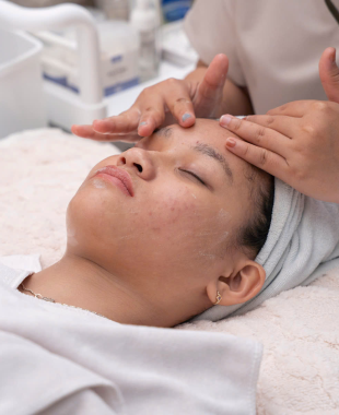 Xử lý nám – Mức độ 2 (gói đồng hành)