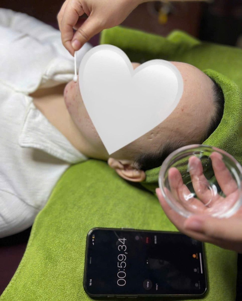 Điều trị da mụn chuyên sâu tại spa Chăm sóc da mặt quận 2 cho da mụn – Giải pháp an toàn, không để sẹo