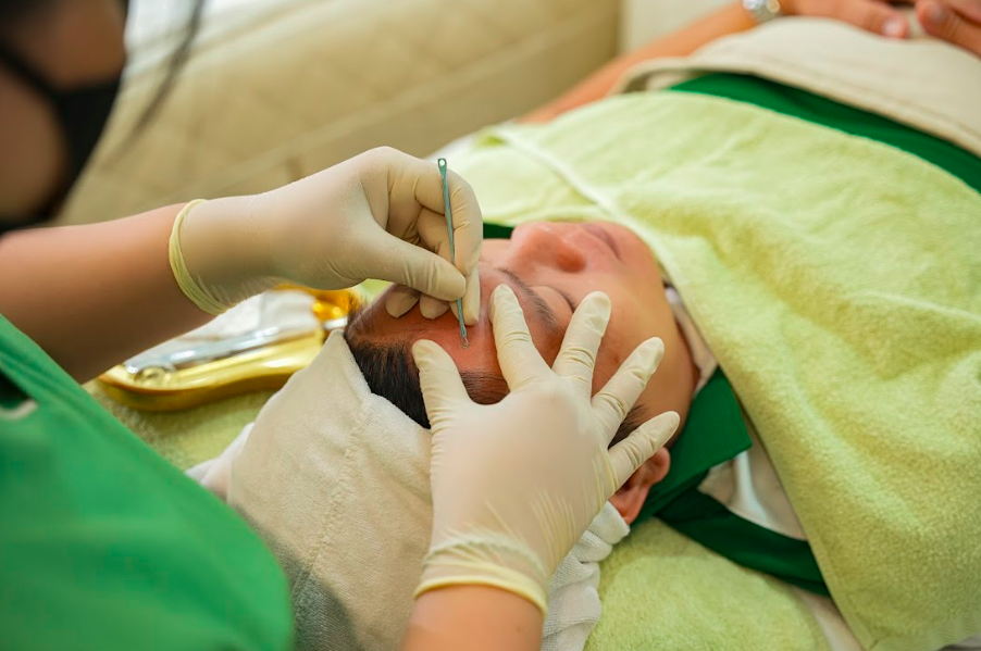 Kỹ thuật viên lấy nhân mụn chuẩn y khoa Chăm sóc da mặt quận 2 cho da mụn – Giải pháp an toàn, không để sẹo
